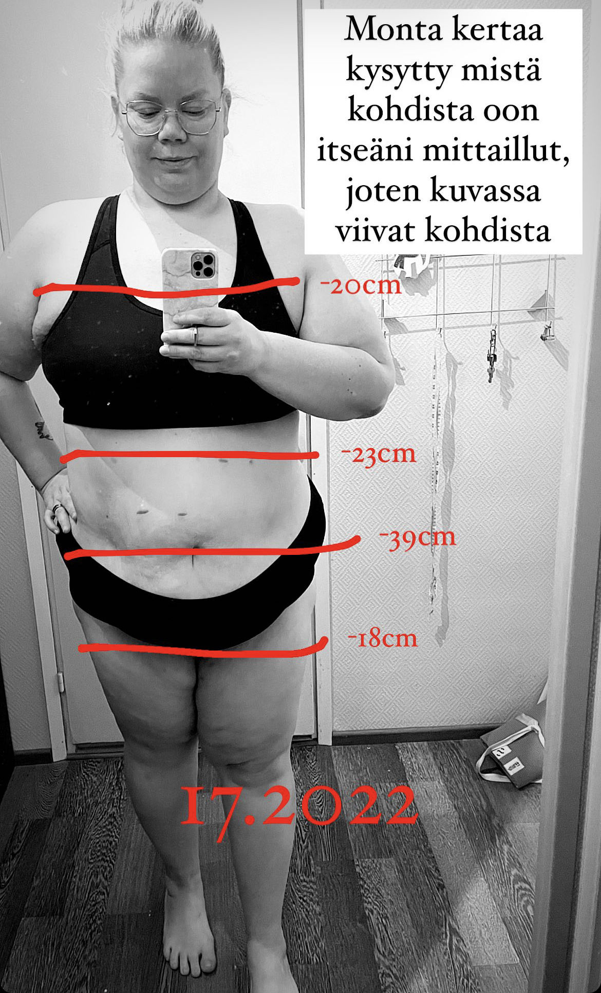 Viroon lihavuusleikkaukseen