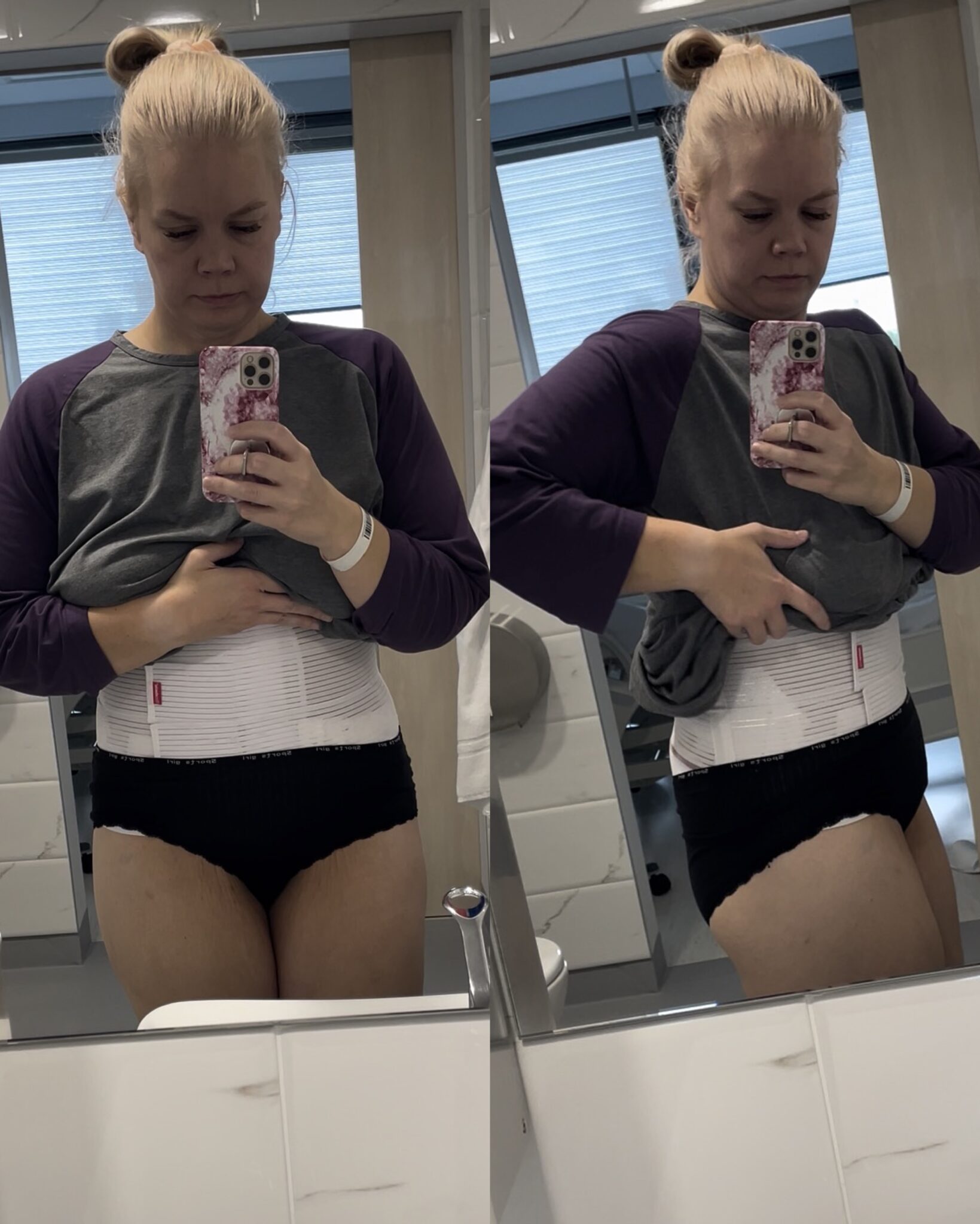 Roikkoleikkauksen jälkeen ensimmäinen wc reissu 