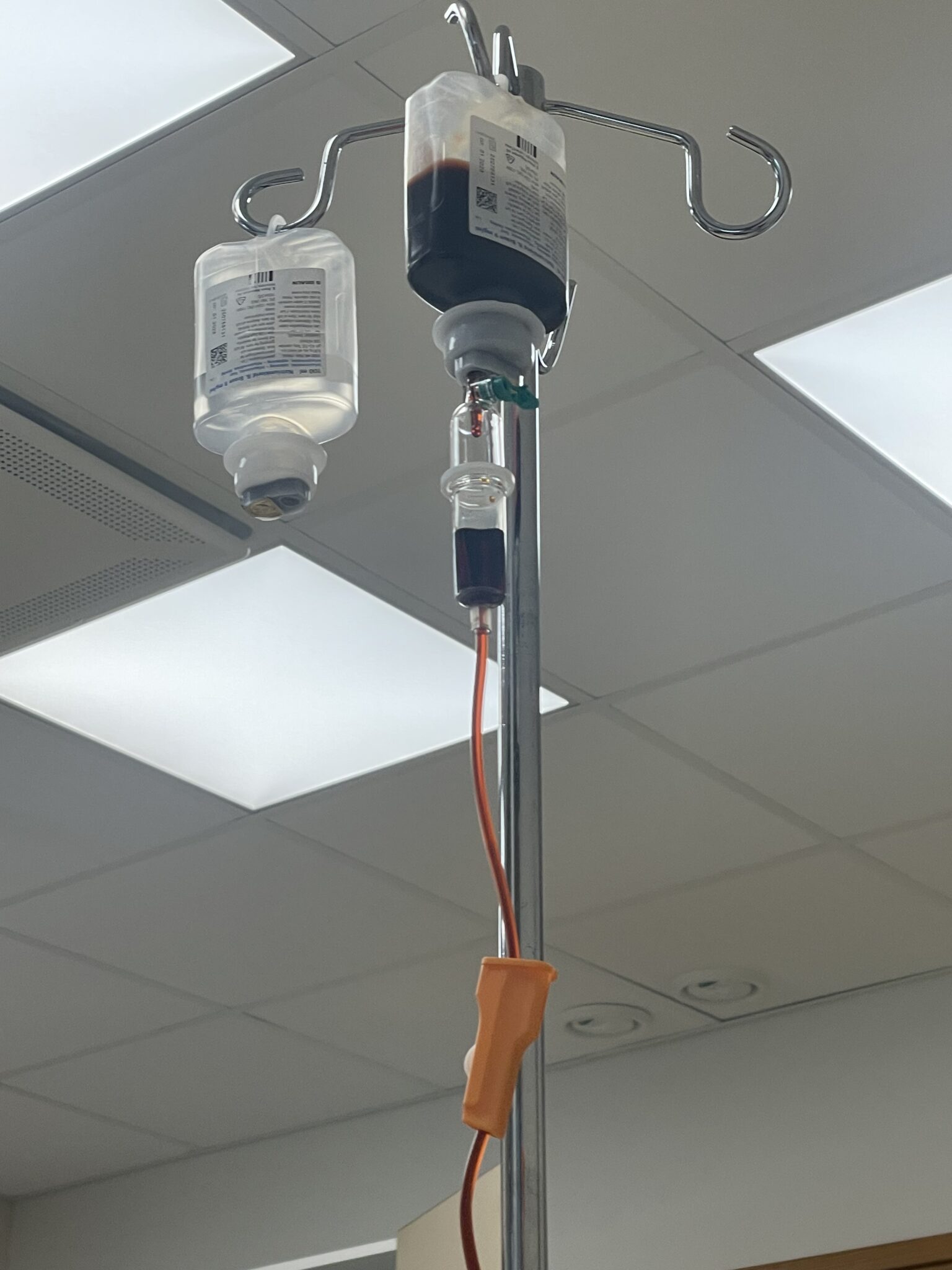 rautainfuusio suoraan suoneen