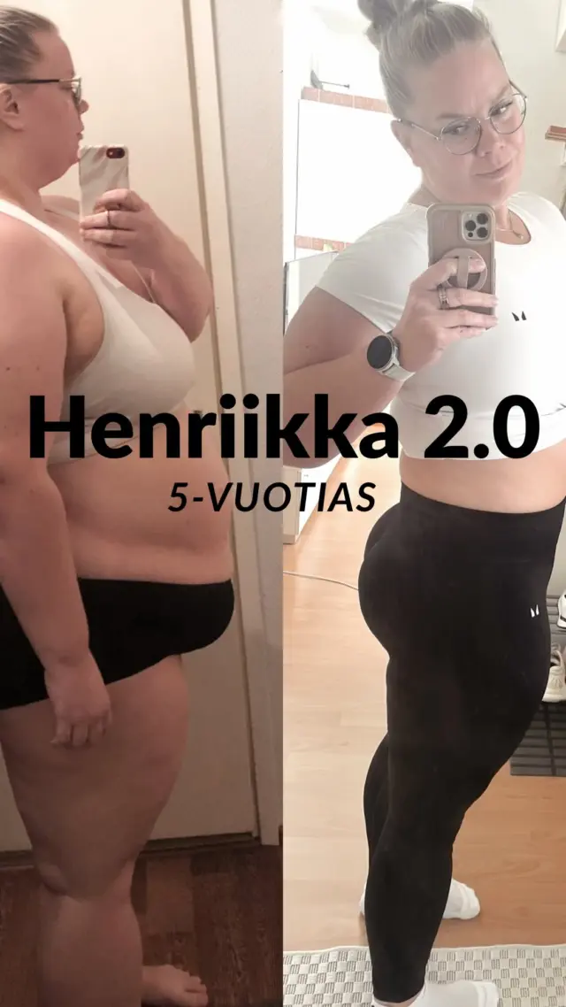 🩷 5 vuotta 🩷

Yli 80 pudotettua kiloa, mutta vielä paljon enemmän elettyä elämää, opittuja asioita ja muutosta, jota ei voi mitata vaa’alla.

Lihavuusleikkaus on osa mun tarinaa, mutta se ei ole koko tarina.

Ja ehkä juuri sen ymmärtäminen on ollut yksi näiden viiden vuoden tärkeimmistä oivalluksista.

💬 Jos saisit kysyä multa yhden asian näistä viidestä vuodesta tai lihavuusleikkauksen jälkeisestä elämästä, mitä haluaisit tietää?

#lihavuusleikkaus #elämäntapamuutos #painonpudotus